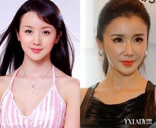 探秘明星整容的秘密，神秘美容小店的魅力所在！